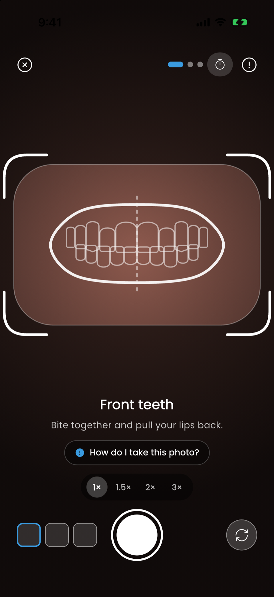 SmileAI camera guide for a front-teeth photo